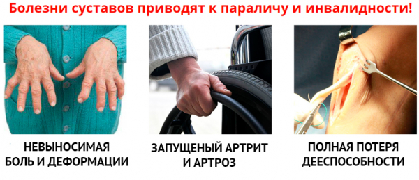 Пантогор – гель, который восстановит ваши суставы и вернёт вам радость жизни
Пантогор – гель, который восстановит ваши суставы и вернёт вам радость жизни