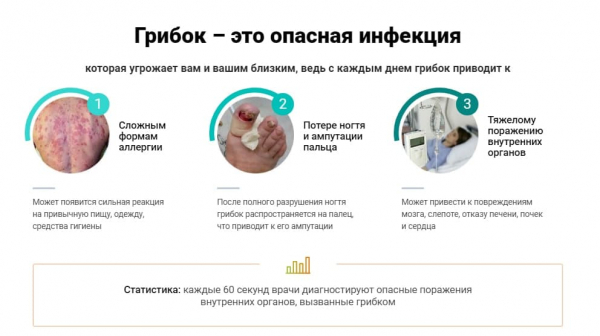 Ремитазол от грибка
Ремитазол от грибка