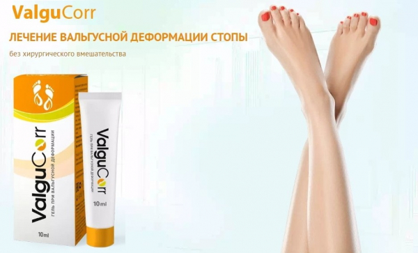  Вальгукорр при вальгусной деформации 