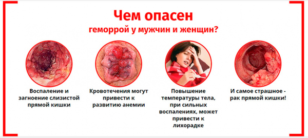 
Средство Проктонол для лечения и профилактики геморроя 