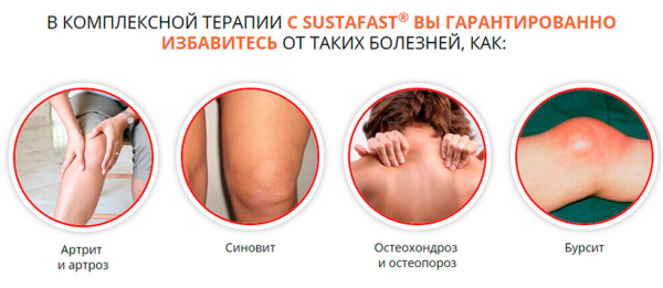 Сустафаст – эффективный препарат для суставов
Сустафаст – эффективный препарат для суставов