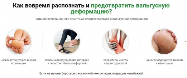 Крем гель Вальгурон
Крем гель Вальгурон
