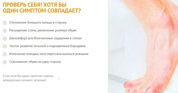 
Вальгукорр при вальгусной деформации 