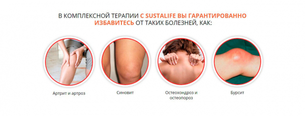 Сусталайф для суставов
Сусталайф для суставов