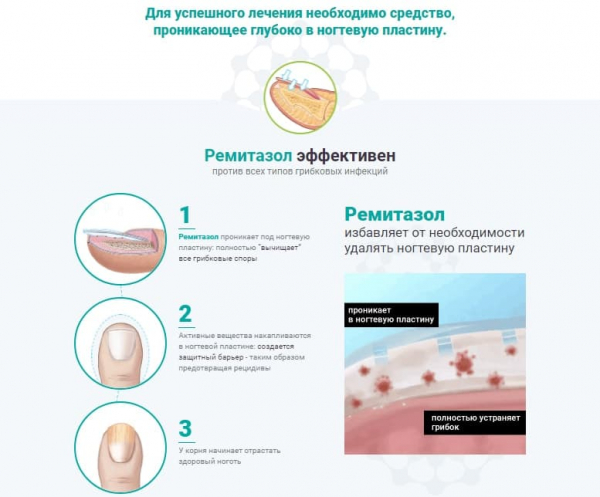 Ремитазол от грибка
Ремитазол от грибка