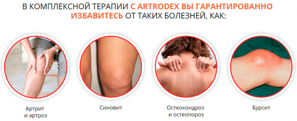 Крем-гель Artrodex при артритах и артрозах
Крем-гель Artrodex при артритах и артрозах