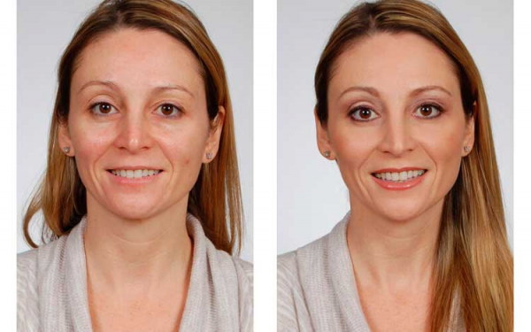 NOIA DERM для кожи
NOIA DERM для кожи