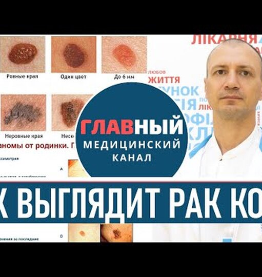 Защита от рака кожи: как правильно наносить санскрин, что ещё сделать для профилактики, как вовремя распознать? Защита от рака кожи: как правильно наносить санскрин, что ещё сделать для профилактики, как вовремя распознать?