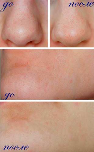 Очиститель Beauty Skin Care
Очиститель Beauty Skin Care