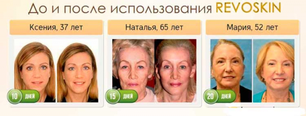 Массажер Revoskin для лица
Массажер Revoskin для лица