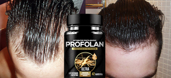 Profolan для волос
Profolan для волос