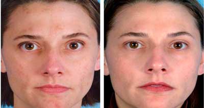 Очиститель Beauty Skin Care
Очиститель Beauty Skin Care