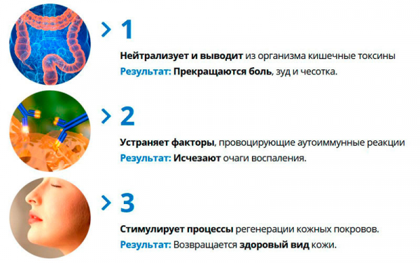 Мицеликс от псориаза
Мицеликс от псориаза
