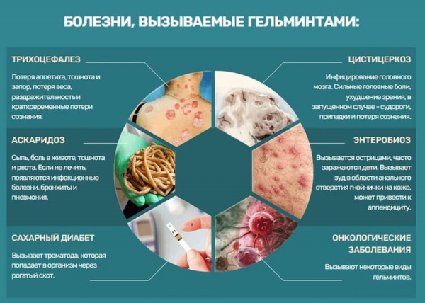  Параксан от паразитов 