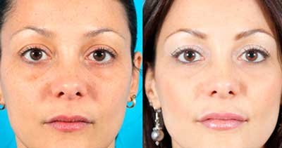 Очиститель Beauty Skin Care
Очиститель Beauty Skin Care