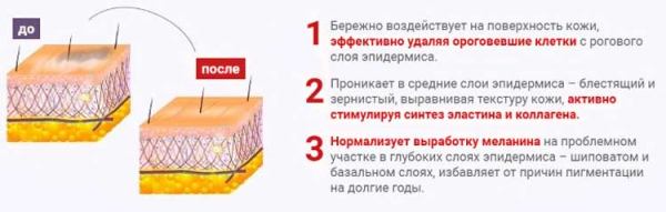 
Пилинг LUMIDERM 