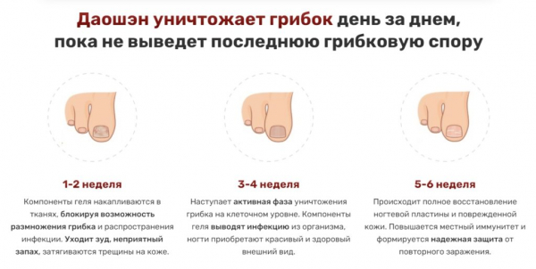 Даошэн — гель от грибка Даошэн — гель от грибка