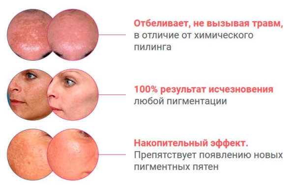 
Пилинг LUMIDERM 