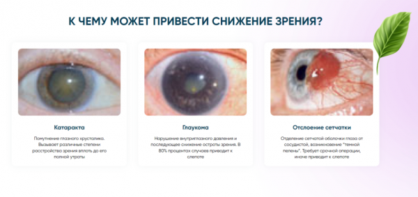 Лоцерин для глаз
Лоцерин для глаз
