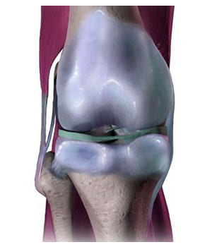 Chondroxin Chondroxin