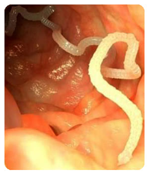 Parazitol Parazitol