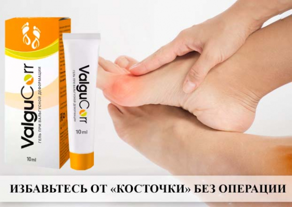Вальгукорр
Вальгукорр