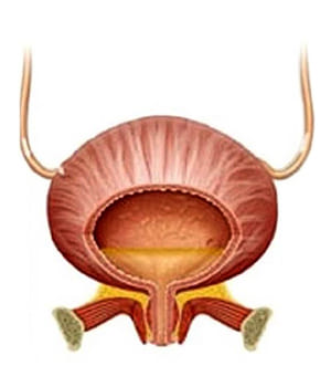 Cystonette Cystonette