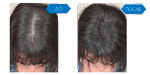 
Hair Drugs для волос 