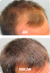 
Voloxin для волос 