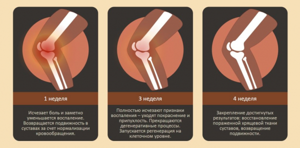 Arthron Meridian для суставов
Arthron Meridian для суставов