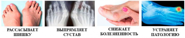 Вальгукорр
Вальгукорр