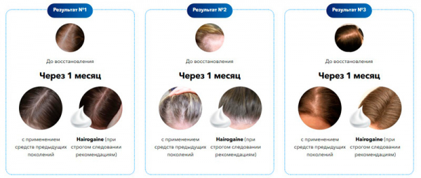 Hairogane для волос
Hairogane для волос