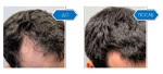 
Hair Drugs для волос 