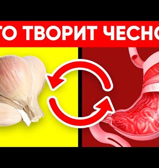 Что будет с телом, если есть чеснок каждый день Что будет с телом, если есть чеснок каждый день