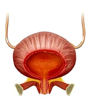 Cystonette Cystonette