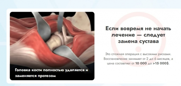 Arthron Meridian для суставов
Arthron Meridian для суставов