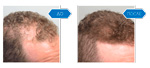 
Hair Drugs для волос 