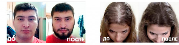 ParikOFF для волос
ParikOFF для волос