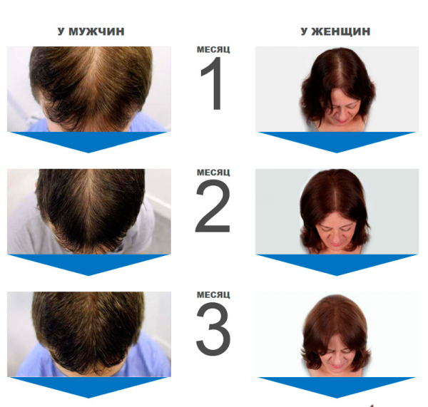 Perfect Hair для волос
Perfect Hair для волос