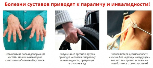 Artex крем-мазь для суставов Artex крем-мазь для суставов