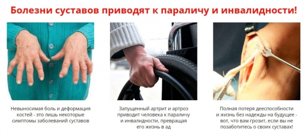 Обзор средства «Артовикс Меридиан»: Стоит ли попробовать Обзор средства «Артовикс Меридиан»: Стоит ли попробовать