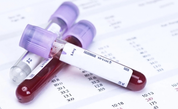 Можно ли диагностировать рак по анализу крови
Можно ли диагностировать рак по анализу крови