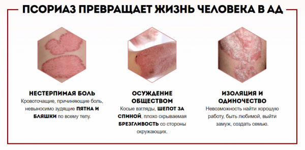Оптидермал от псориаза
Оптидермал от псориаза