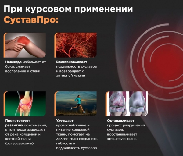 «СУСТАВ ПРО» гель для суставов – инструкция по применению, цена, отзывы, аналоги
«СУСТАВ ПРО» гель для суставов – инструкция по применению, цена, отзывы, аналоги