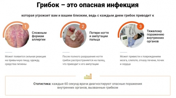 Грибок Протект от грибка ногтей
Грибок Протект от грибка ногтей