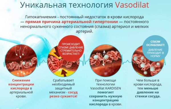 Кардисен от давления
Кардисен от давления