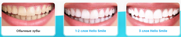 HelloSmile
HelloSmile