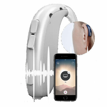 Oticon Xceed
Oticon Xceed