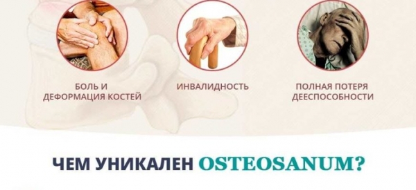 Оsteosanum крем для суставов и связок
Оsteosanum крем для суставов и связок