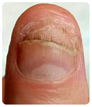 Cormidex Cormidex